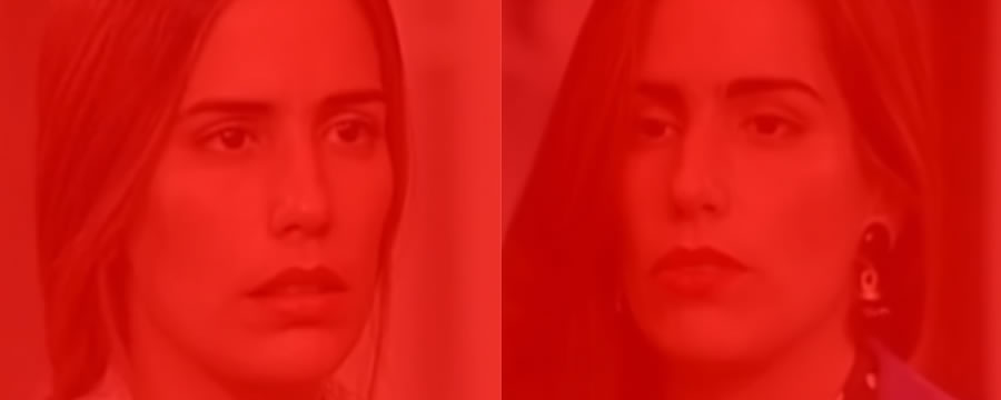 Hérnia de Disco e Protusão Discal: irmãos de causa e tratamento