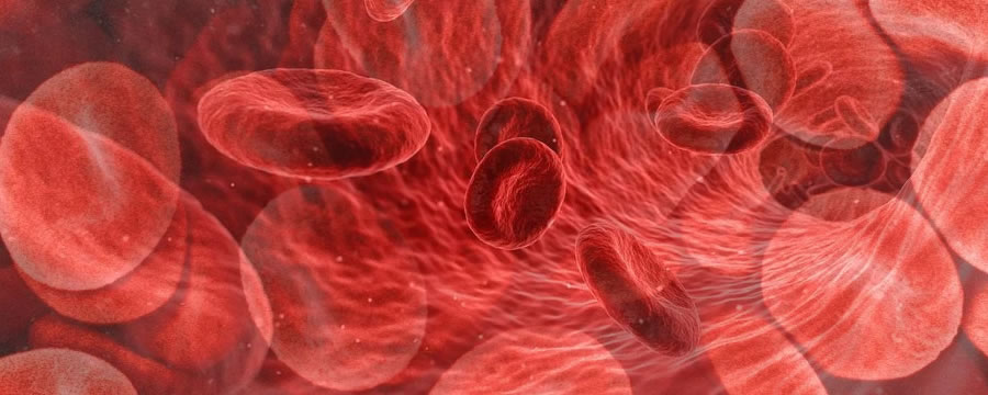Hemangioma: um pouco de sangue a mais
