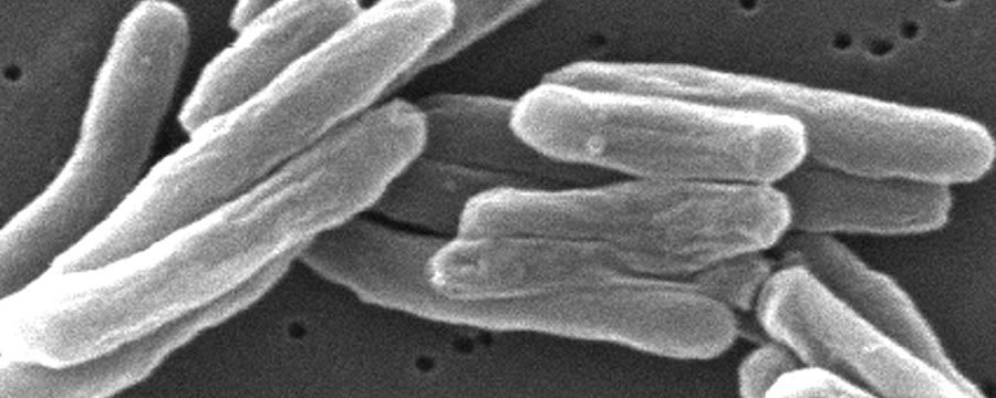Tuberculose: uma doença rara, um problema que persiste em nossos tempos
